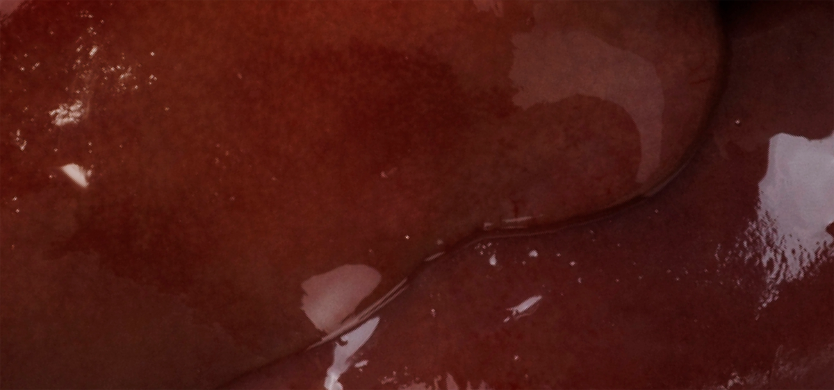 Chicken Liver